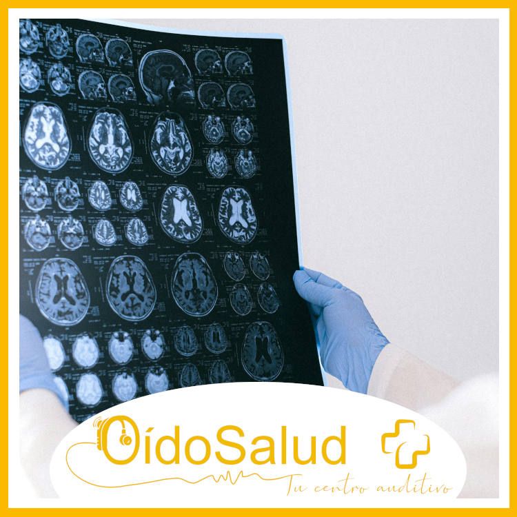 El Día Mundial del Cerebro